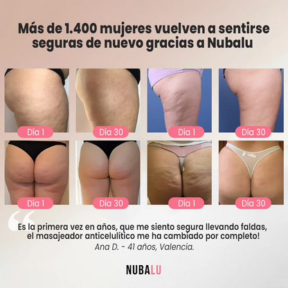 Masajeador Anticelulítico 5 en 1